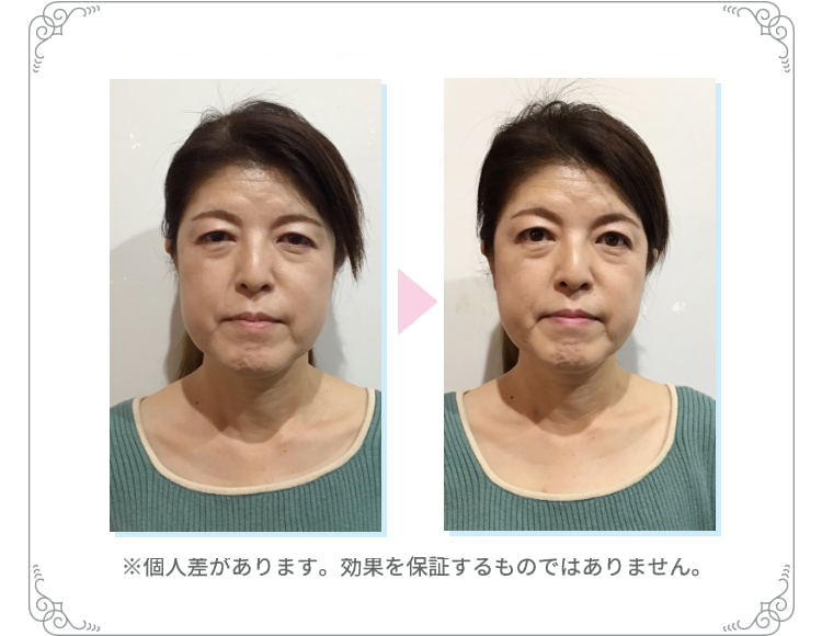 お試し効果1※個人差があります。効果を保証するものではありません