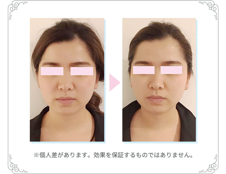 お試し効果2※個人差があります。効果を保証するものではありません