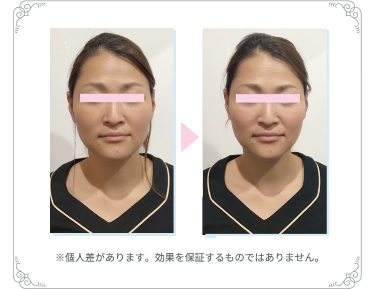 お試し効果3※個人差があります。効果を保証するものではありません
